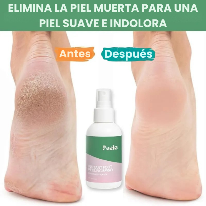 Peele™ Spray exfoliante instantáneo para pies