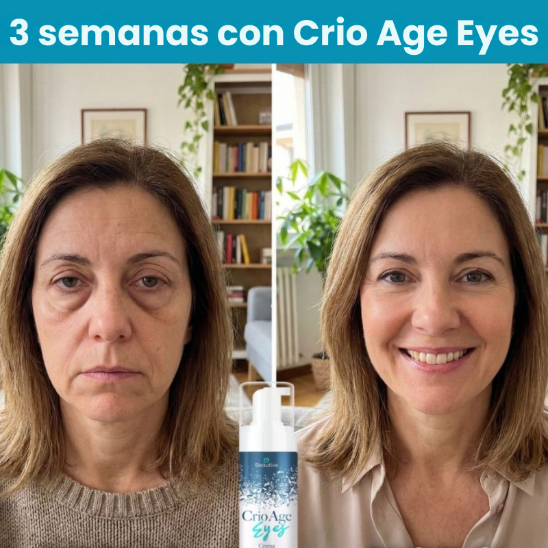 PAGA 1 LLEVA 2 elimina las bolsas bajo los ojos y recupera una mirada fresca