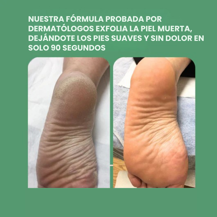 Peele™ Spray exfoliante instantáneo para pies
