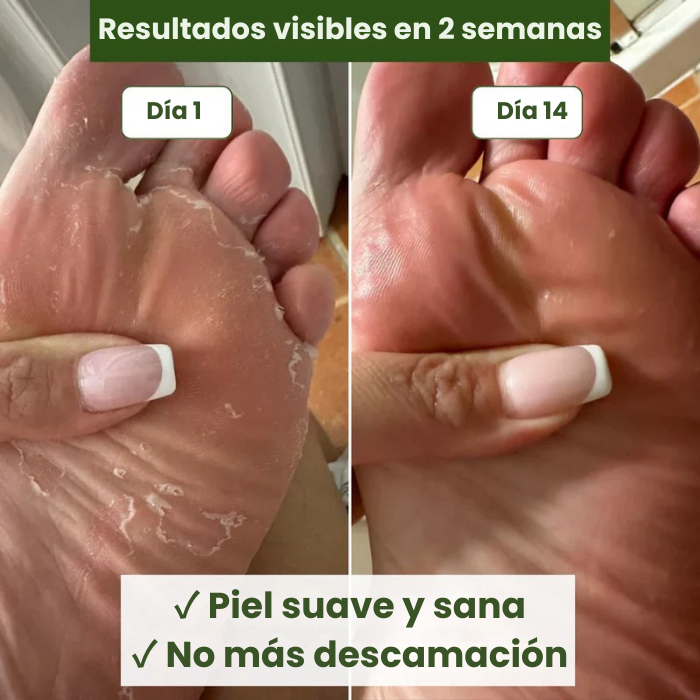 Jabón antimicótico