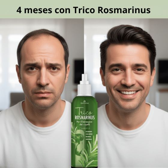 Detén la caída y recupera tu melena de hace 10 años con Trico Rosmarinus