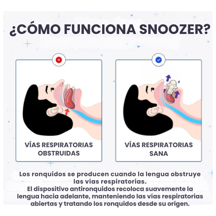 PAGA 1 LLEVA 2 Alivio instantáneo de los ronquidos