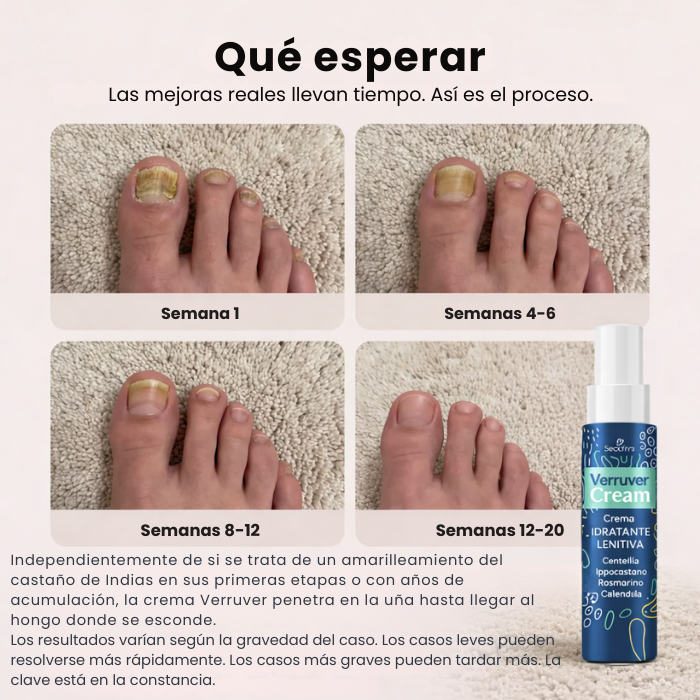 PAGA 1 LLEVA 2 Crema tratamiento para los hongos de uñas