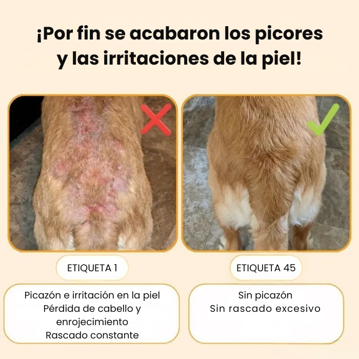 Tratamientos para la picazón y las alergias