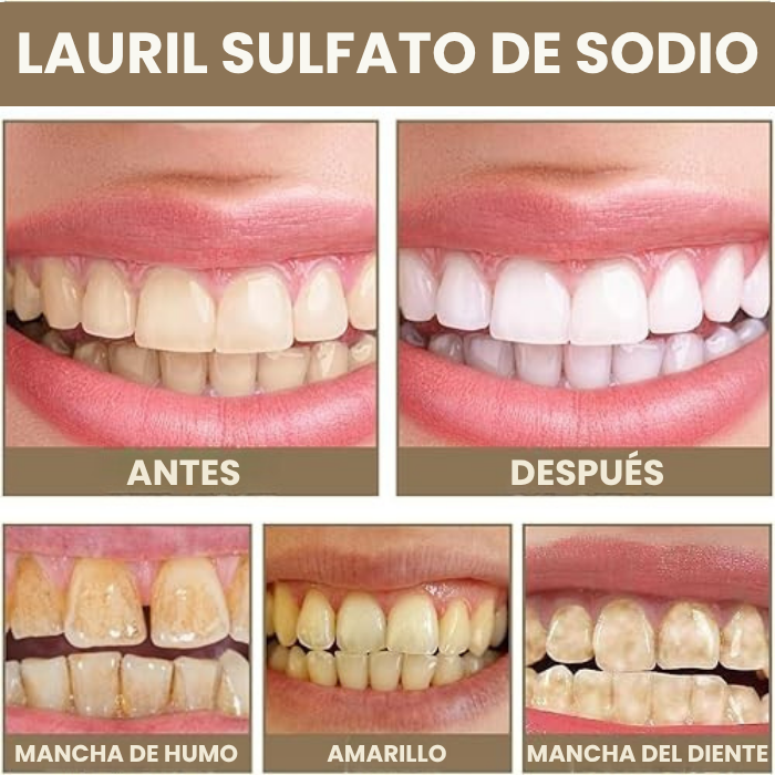 Pasta dental para el cuidado bucal, aliento fresco, previene la pérdida de dientes, ingredientes naturales, cuidado suave