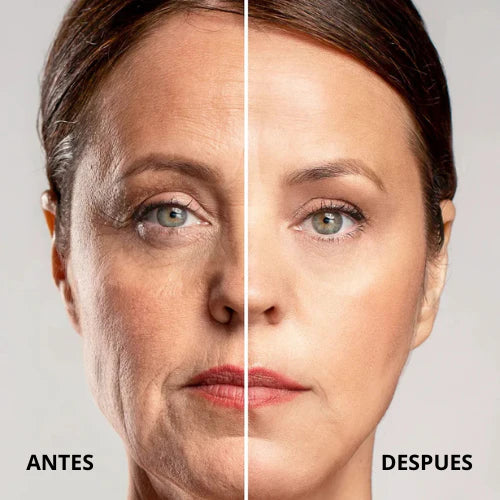 🎁 PAGA 1 LLEVA 2 Bálsamo Antiarrugas – Una Piel más suave, firme y luminosa