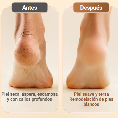 Removedor de callos pies perfectos