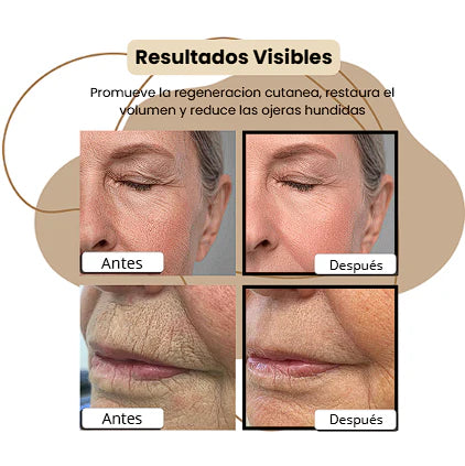 🎁 PAGA 1 LLEVA 2 Bálsamo Antiarrugas – Una Piel más suave, firme y luminosa