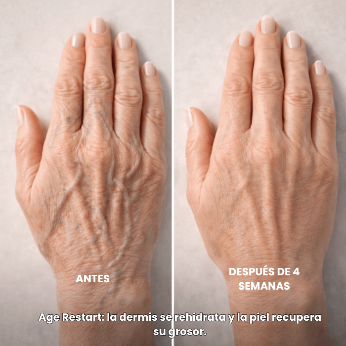PAGA 1 LLEVA 2 Crema de manos Age Restart: Devuelve la firmeza y cuidado a tu piel