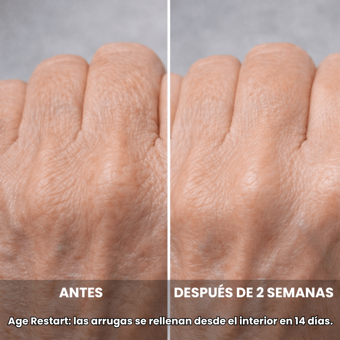 PAGA 1 LLEVA 2 Crema de manos Age Restart: Devuelve la firmeza y cuidado a tu piel