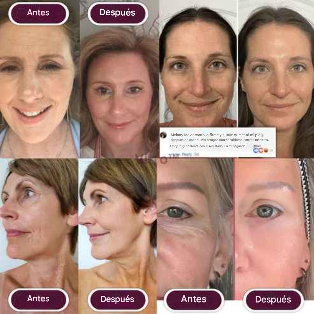 Barra coreana reafirmante y antienvejecimiento