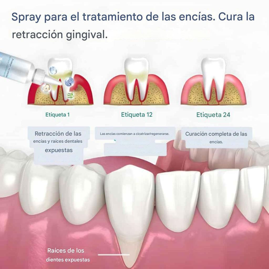 Spray Gum Protect revitaliza las encías y blanquea los dientes durante la primera semana.
