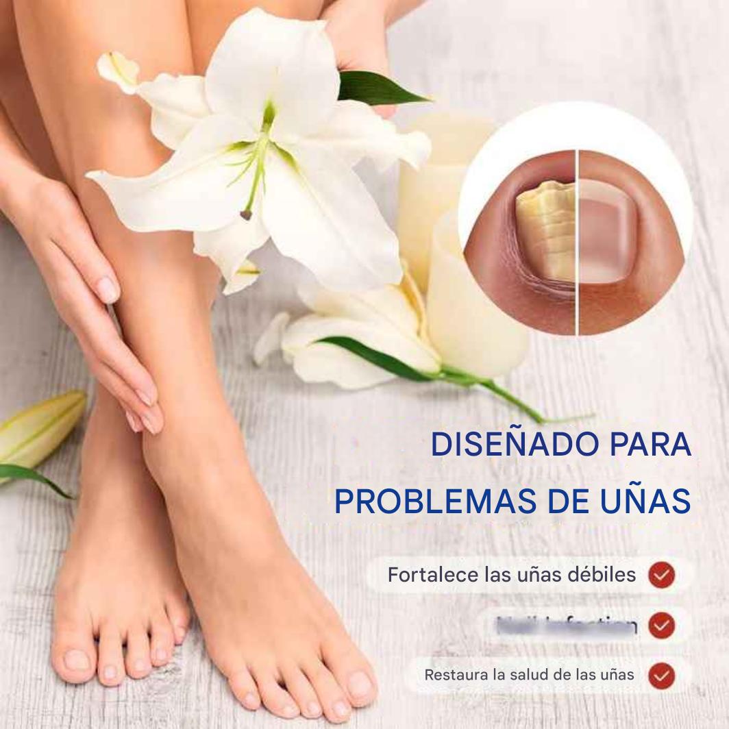 Reparación de uñas NailAura Extra Fuerte