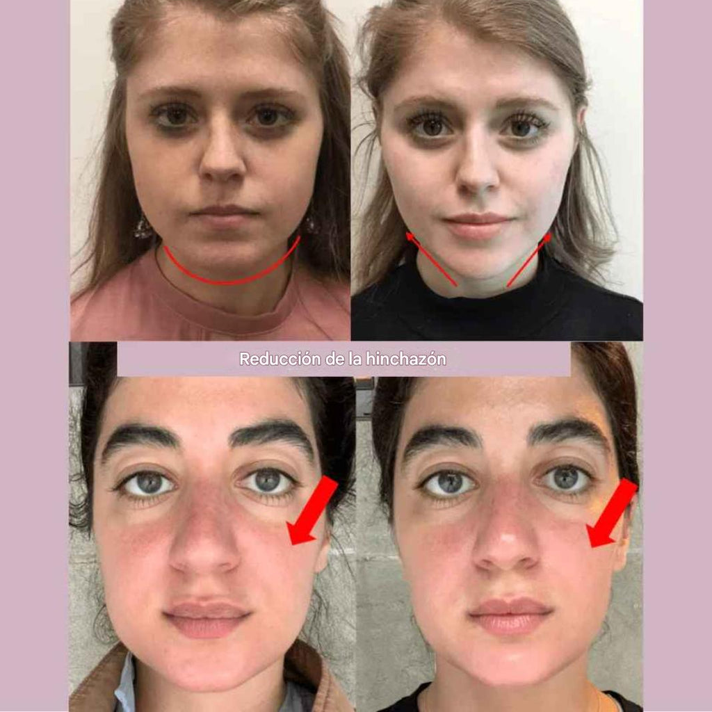 Mascarilla de contorno facial - Suaviza arrugas, papada y moldea el rostro