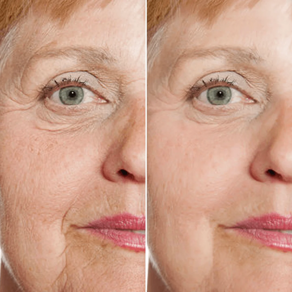 Sérum facial rejuvenecedor
