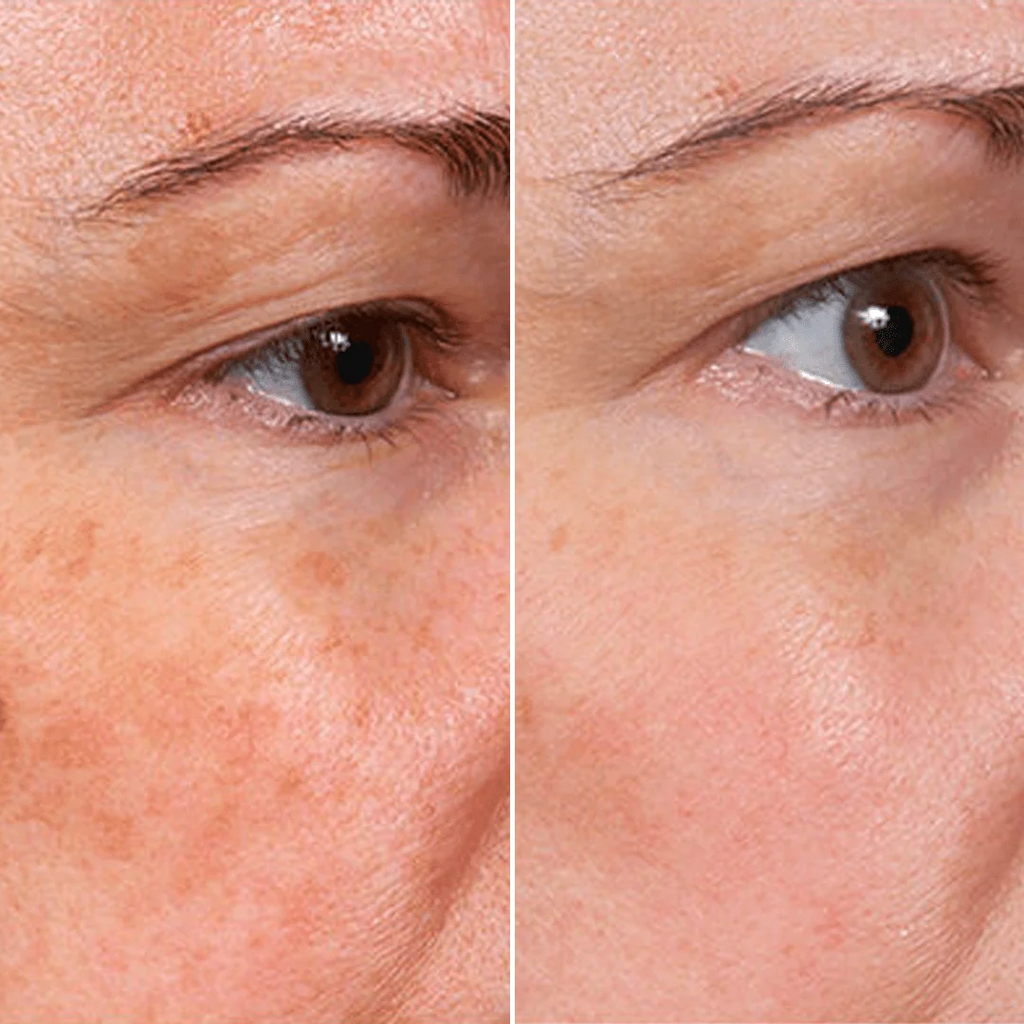 Sérum facial rejuvenecedor