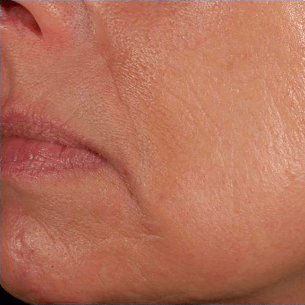 Sérum facial rejuvenecedor