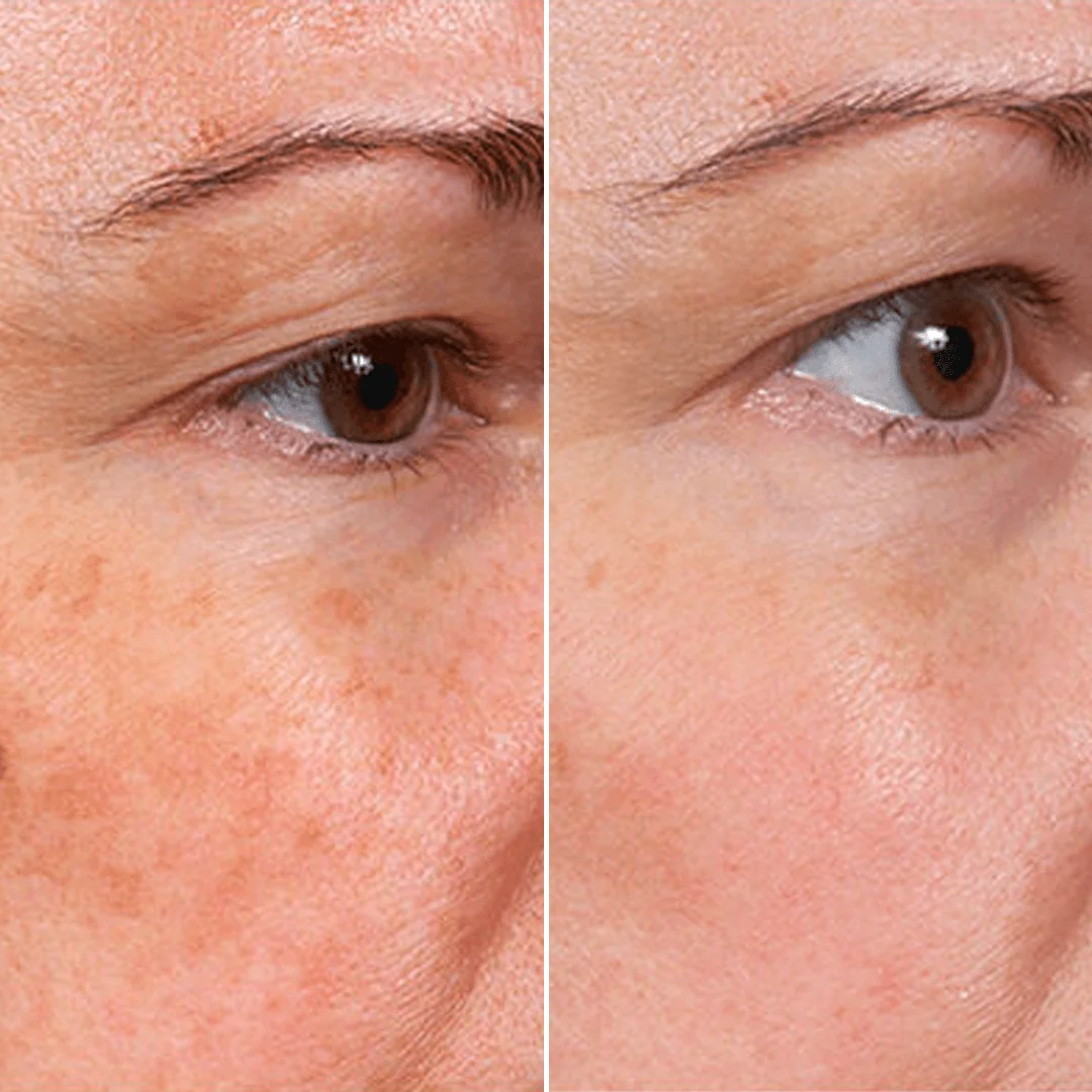 Sérum facial rejuvenecedor